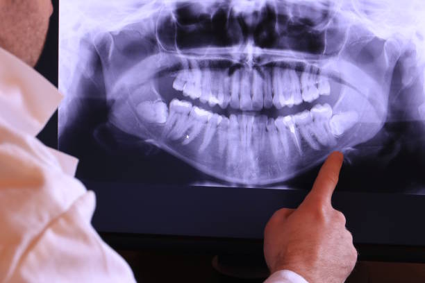 Best Emergency Denture Repair in Monee, IL